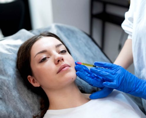 Plasma Rico en Plaquetas (PRP): Rejuvenecimiento Facial