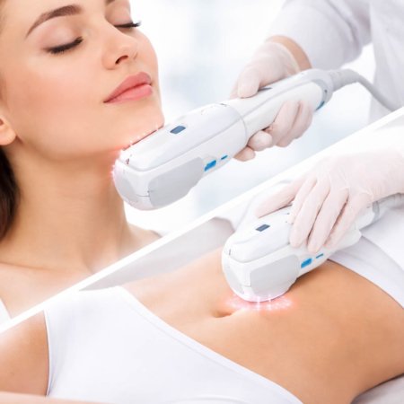 HIFU facial y corporal